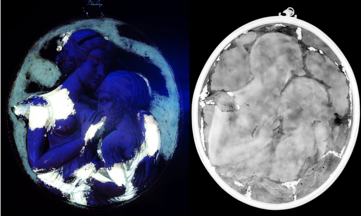 x-ray image